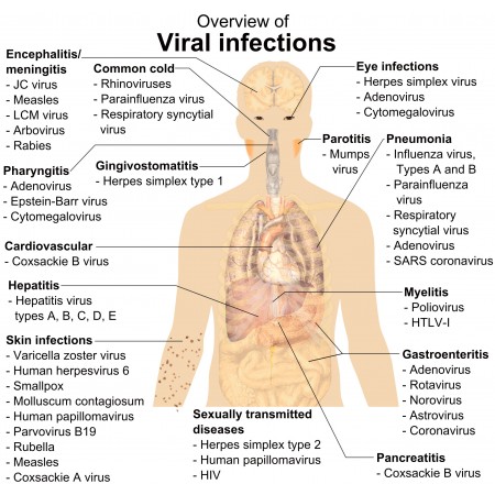 25x24in Poster Simplistic overview of the main viral infections and the most notable involved species